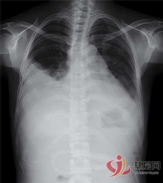 21280813702707028_137.jpg 21280813702707028_137.jpg