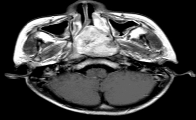 09415749276371167_106.png 09415749276371167_106.png